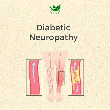 Diabetic Neuropathy Ayurvedic Management 30 Days Pack - Deep Ayurveda India