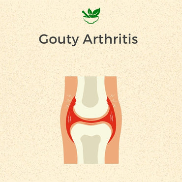 Gouty Arthritis Ayurvedic Management 30 Days Pack - Deep Ayurveda India