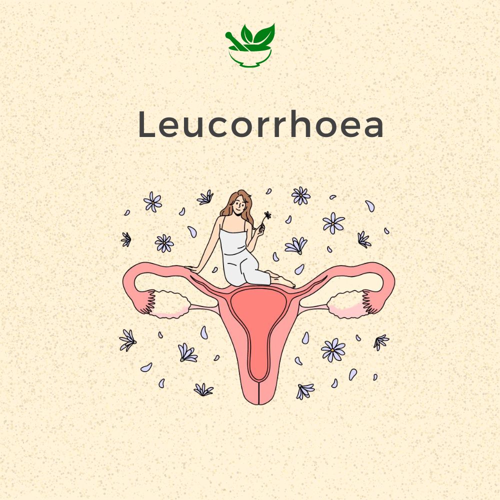 Leucorrhea Ayurvedic Management 30 Days Pack - Deep Ayurveda India